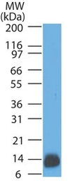 Anti-S100 beta antibody [4C4.9] used in Western Blot (WB). GTX04511