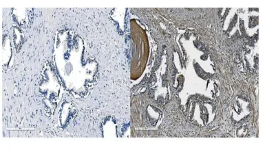 Anti-CDH11 antibody used in IHC (Paraffin sections) (IHC-P). GTX04544