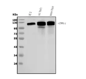 Anti-CDH11 antibody used in Western Blot (WB). GTX04544