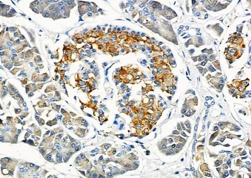 Anti-Klotho antibody used in IHC (Paraffin sections) (IHC-P). GTX04566