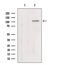 Anti-Klotho antibody used in Western Blot (WB). GTX04566