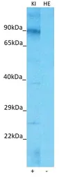 Anti-TMEM26 antibody used in Western Blot (WB). GTX04582