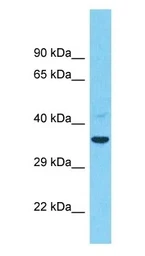 Anti-TMEM26 antibody used in Western Blot (WB). GTX04582