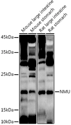 Anti-NMU antibody used in Western Blot (WB). GTX04674