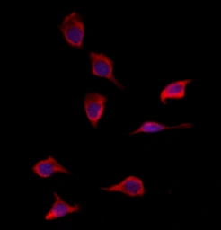 Anti-SOD3 antibody used in Immunocytochemistry/ Immunofluorescence (ICC/IF). GTX04694