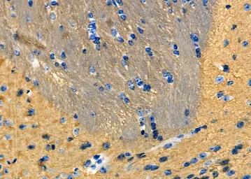 Anti-SOD3 antibody used in IHC (Paraffin sections) (IHC-P). GTX04694