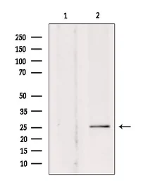 Anti-SOD3 antibody used in Western Blot (WB). GTX04694