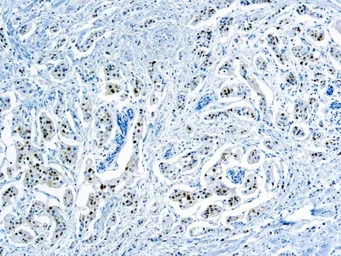 Anti-Cyclin D1 antibody [SP4] used in IHC (Paraffin sections) (IHC-P). GTX04743