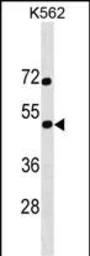 Anti-CREST antibody used in Western Blot (WB). GTX04747