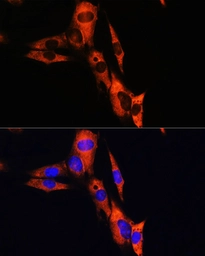 Anti-Sodium/Potassium ATPase beta 1 antibody used in Immunocytochemistry/ Immunofluorescence (ICC/IF). GTX04754