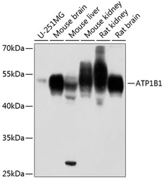 Anti-Sodium/Potassium ATPase beta 1 antibody used in Western Blot (WB). GTX04754