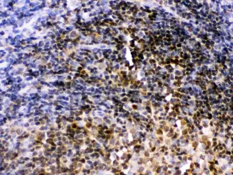 Anti-PAX2 antibody used in IHC (Paraffin sections) (IHC-P). GTX04784