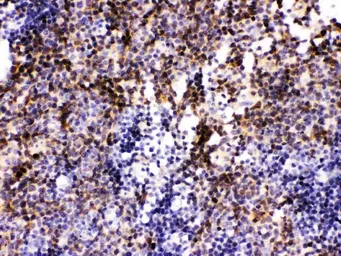 Anti-PAX2 antibody used in IHC (Paraffin sections) (IHC-P). GTX04784