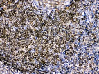 Anti-PAX2 antibody used in IHC (Paraffin sections) (IHC-P). GTX04784