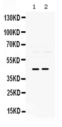 Anti-PAX2 antibody used in Western Blot (WB). GTX04784