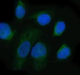 Anti-Integrin alpha 6 antibody [DHG-9] used in Immunocytochemistry/ Immunofluorescence (ICC/IF). GTX04931