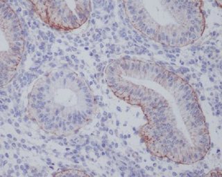 Anti-Integrin alpha 6 antibody [DHG-9] used in IHC (Paraffin sections) (IHC-P). GTX04931