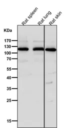 Anti-Integrin alpha 6 antibody [DHG-9] used in Western Blot (WB). GTX04931