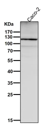 Anti-Integrin alpha 6 antibody [DHG-9] used in Western Blot (WB). GTX04931