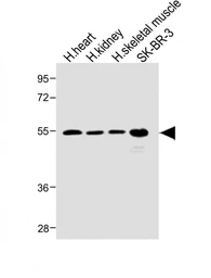 Anti-SPNS2 antibody, N-term used in Western Blot (WB). GTX04943