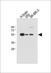 Anti-SPNS2 antibody, N-term used in Western Blot (WB). GTX04943