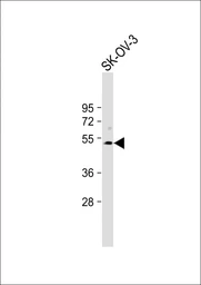 Anti-SPNS2 antibody, N-term used in Western Blot (WB). GTX04943