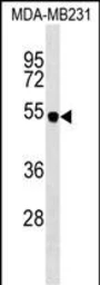 Anti-SPNS2 antibody, N-term used in Western Blot (WB). GTX04943