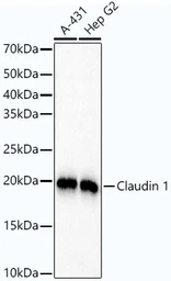 Anti-Claudin 1 antibody [ARC54475] used in Western Blot (WB). GTX04993