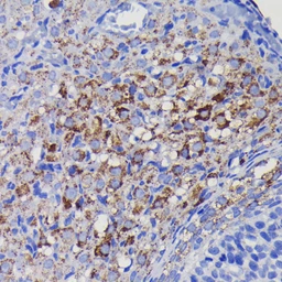 Anti-SOD2 antibody [GT1165] used in IHC (Paraffin sections) (IHC-P). GTX09013