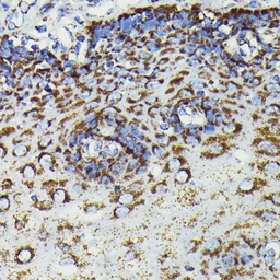 Anti-SOD2 antibody [GT1165] used in Immunocytochemistry/ Immunofluorescence (ICC/IF). GTX09013