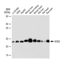 Anti-SOD2 antibody [GT1165] used in Western Blot (WB). GTX09013