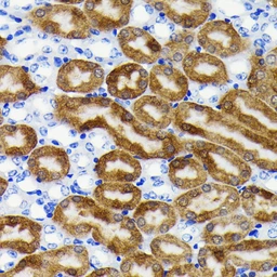 Anti-NQO1 antibody [GT1171] used in IHC (Paraffin sections) (IHC-P). GTX09504