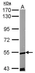 Anti-ROR alpha antibody [N2N3] used in Western Blot (WB). GTX100029