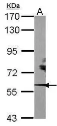 Anti-ROR alpha antibody [N2N3] used in Western Blot (WB). GTX100029