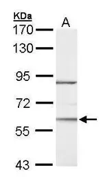 Anti-ROR alpha antibody [N2N3] used in Western Blot (WB). GTX100029