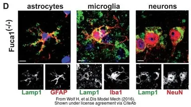 Anti-Iba1 antibody used in Immunocytochemistry/ Immunofluorescence (ICC/IF). GTX100042