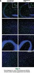 Anti-Iba1 antibody used in IHC (Free Floating) (IHC (Free Floating)). GTX100042