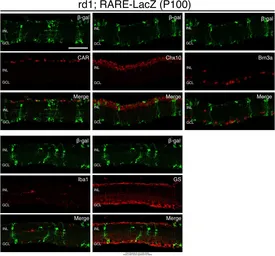 Anti-Iba1 antibody used in IHC (Frozen sections) (IHC-Fr). GTX100042