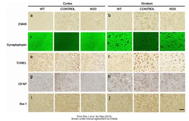 Anti-Iba1 antibody used in Immunohistochemistry (IHC). GTX100042