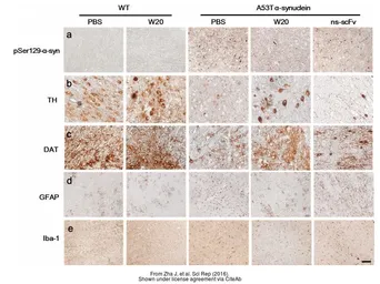 Anti-Iba1 antibody used in Immunohistochemistry (IHC). GTX100042