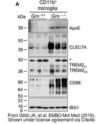 Anti-Iba1 antibody used in Western Blot (WB). GTX100042