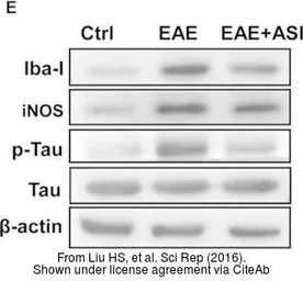 Anti-Iba1 antibody used in Western Blot (WB). GTX100042