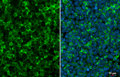 Anti-Iba1 antibody used in Immunocytochemistry/ Immunofluorescence (ICC/IF). GTX100042