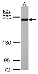 Anti-APXL antibody [C3], C-term used in Western Blot (WB). GTX100055