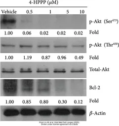 Anti-Bcl-2 antibody [N1N2], N-term used in Western Blot (WB). GTX100064