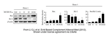 Anti-Bcl-2 antibody [N1N2], N-term used in Western Blot (WB). GTX100064