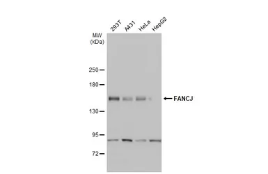 Anti-FANCJ antibody [N1N2], N-term used in Western Blot (WB). GTX100072