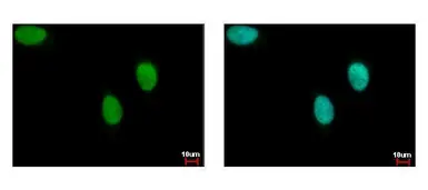 Anti-FANCJ antibody [N1N2], N-term used in Immunocytochemistry/ Immunofluorescence (ICC/IF). GTX100072