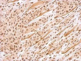 Anti-FANCJ antibody [N1N2], N-term used in IHC (Paraffin sections) (IHC-P). GTX100072