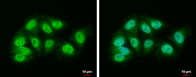 Anti-DDB1 antibody [N1N3] used in Immunocytochemistry/ Immunofluorescence (ICC/IF). GTX100129